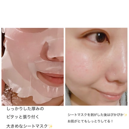 リードルS PDRN+ マスク/VT/シートマスク・パックを使ったクチコミ(6枚目)