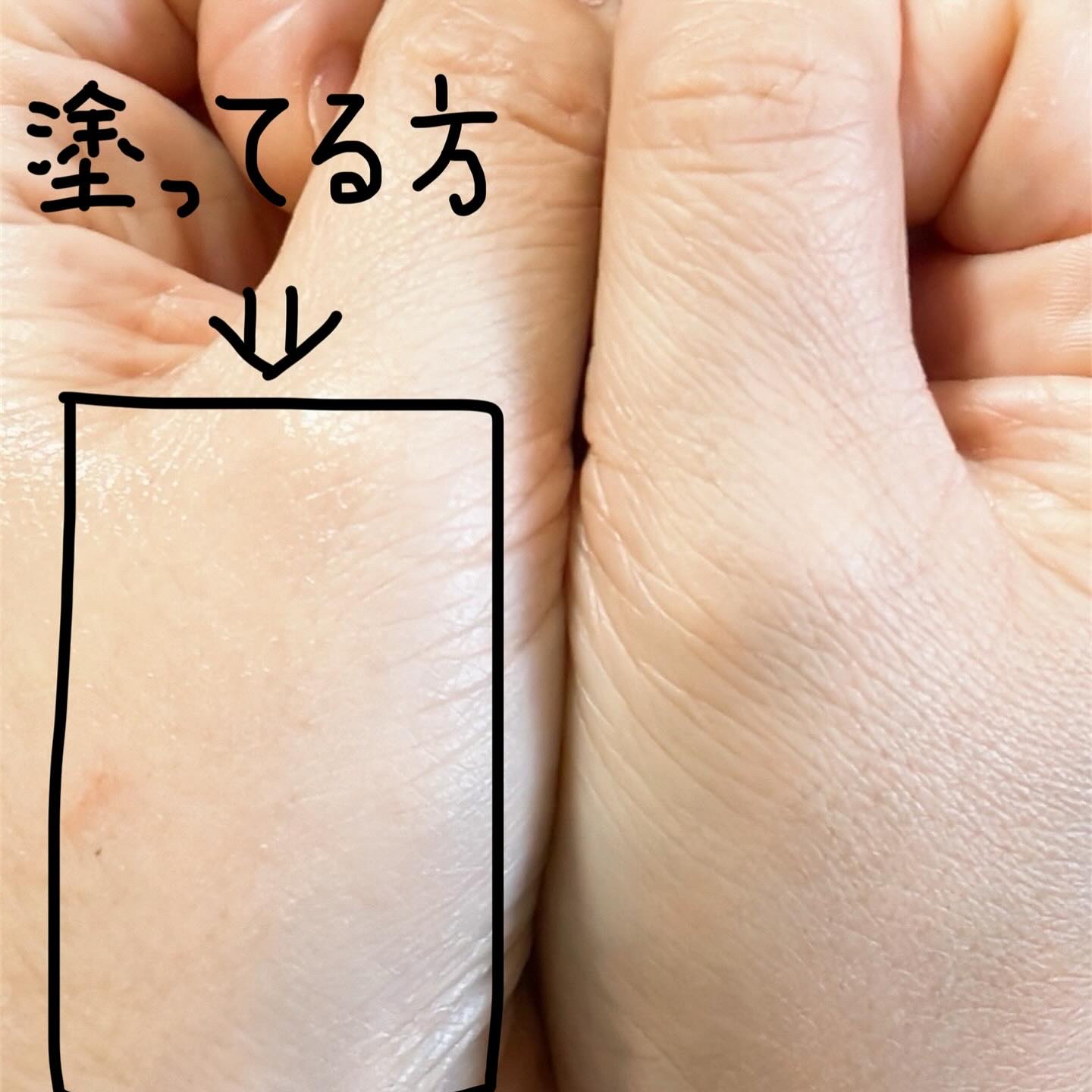 ウルトラグロウバー/b.glen/美容液を使ったクチコミ（3枚目）