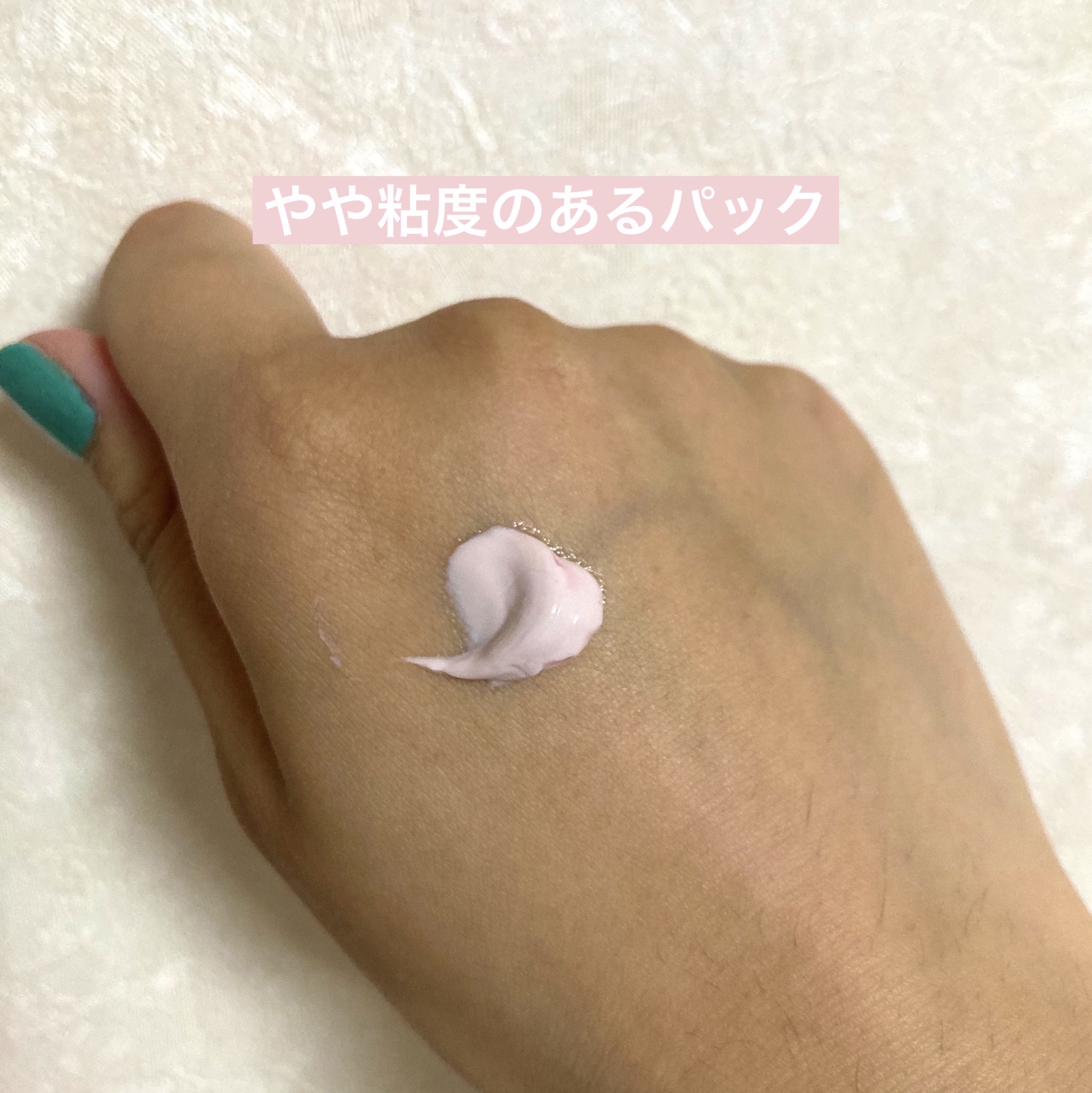 フレッシュドットパック/ももぷり/洗い流すパック・マスクを使ったクチコミ（2枚目）