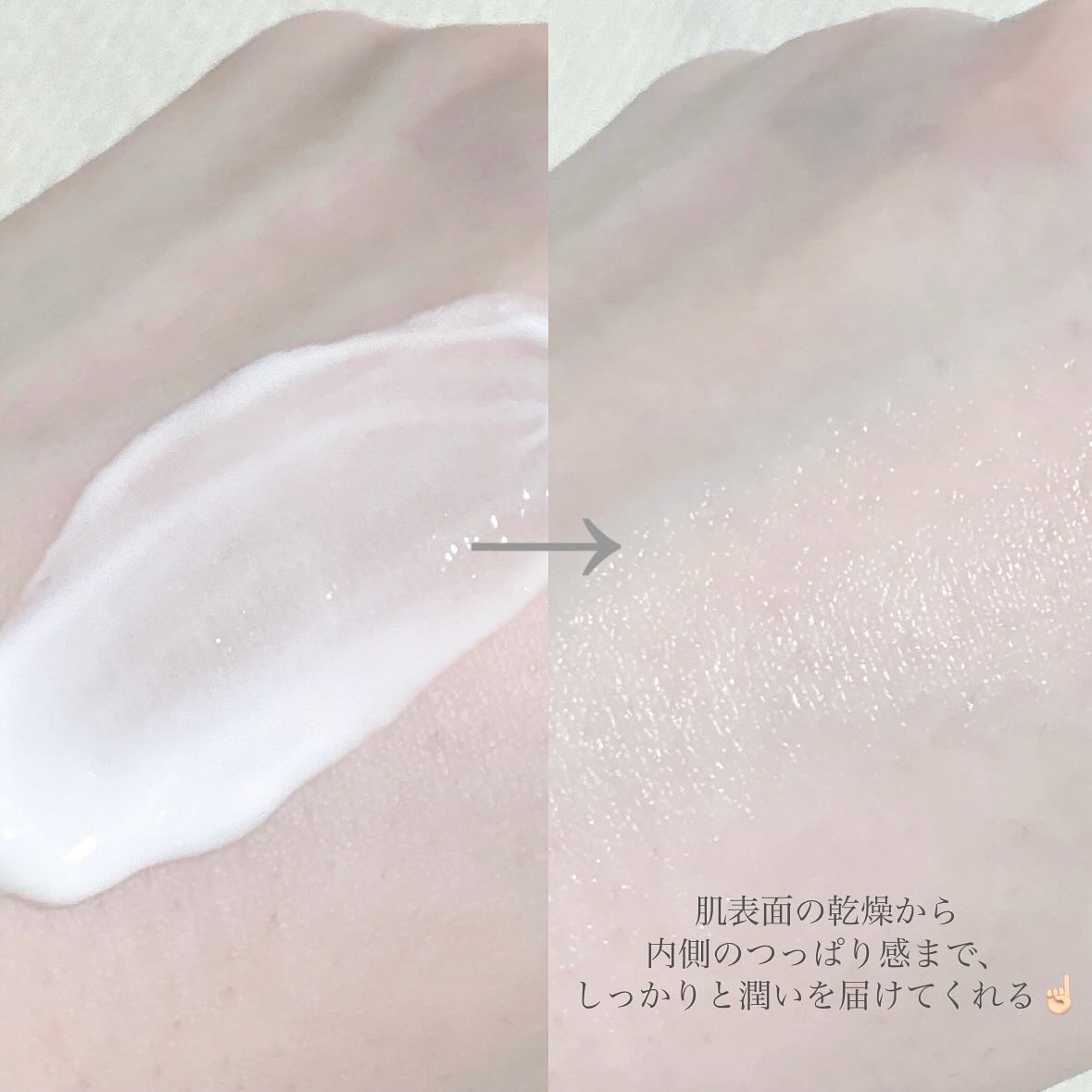 Hug Your Skin Moisture Lotion/celepiderme/化粧水を使ったクチコミ（3枚目）