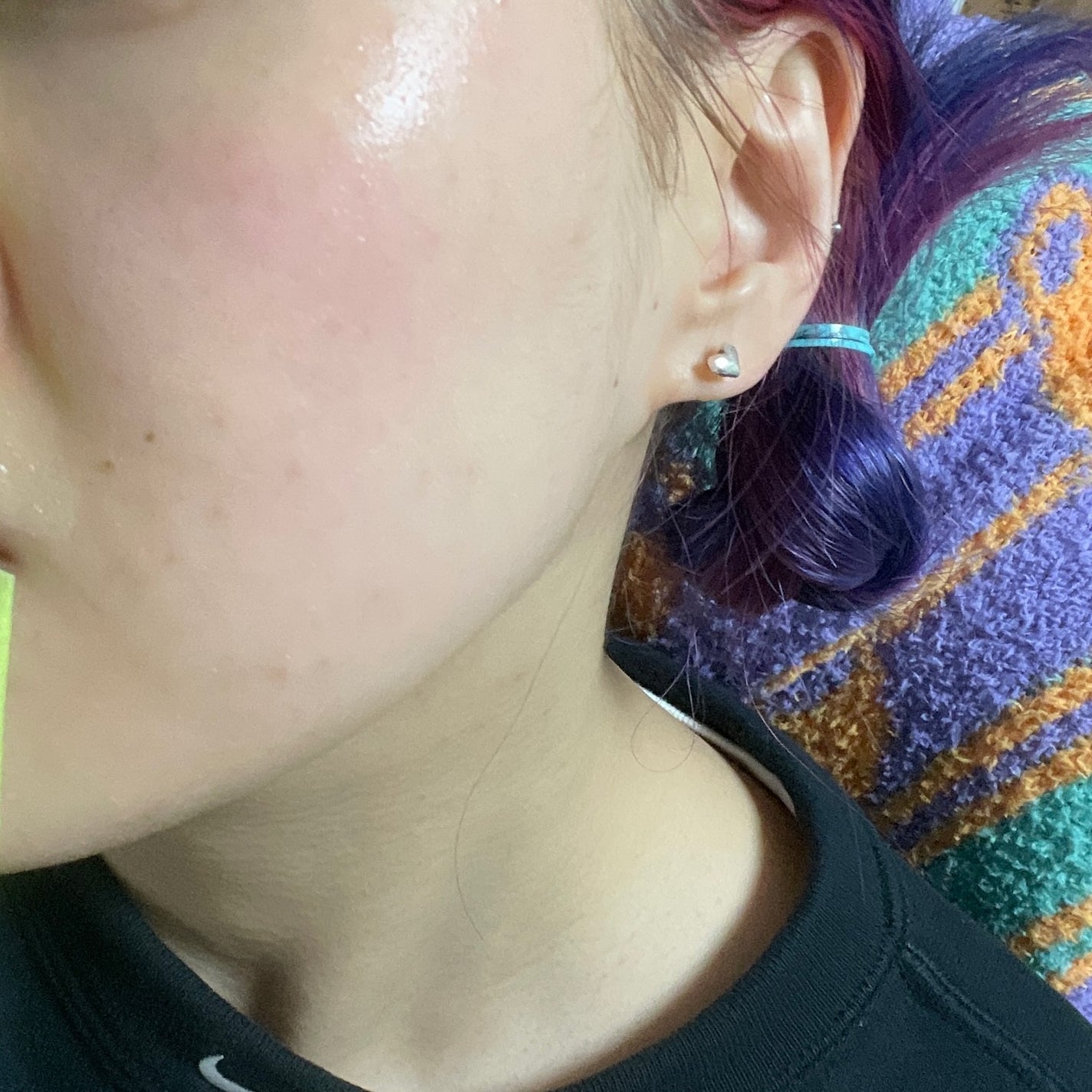 ACディープブレミッシュカーミングマスク/DEWYTREE/シートマスク・パックを使ったクチコミ(5枚目)