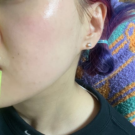 ACディープブレミッシュカーミングマスク/DEWYTREE/シートマスク・パックを使ったクチコミ(5枚目)