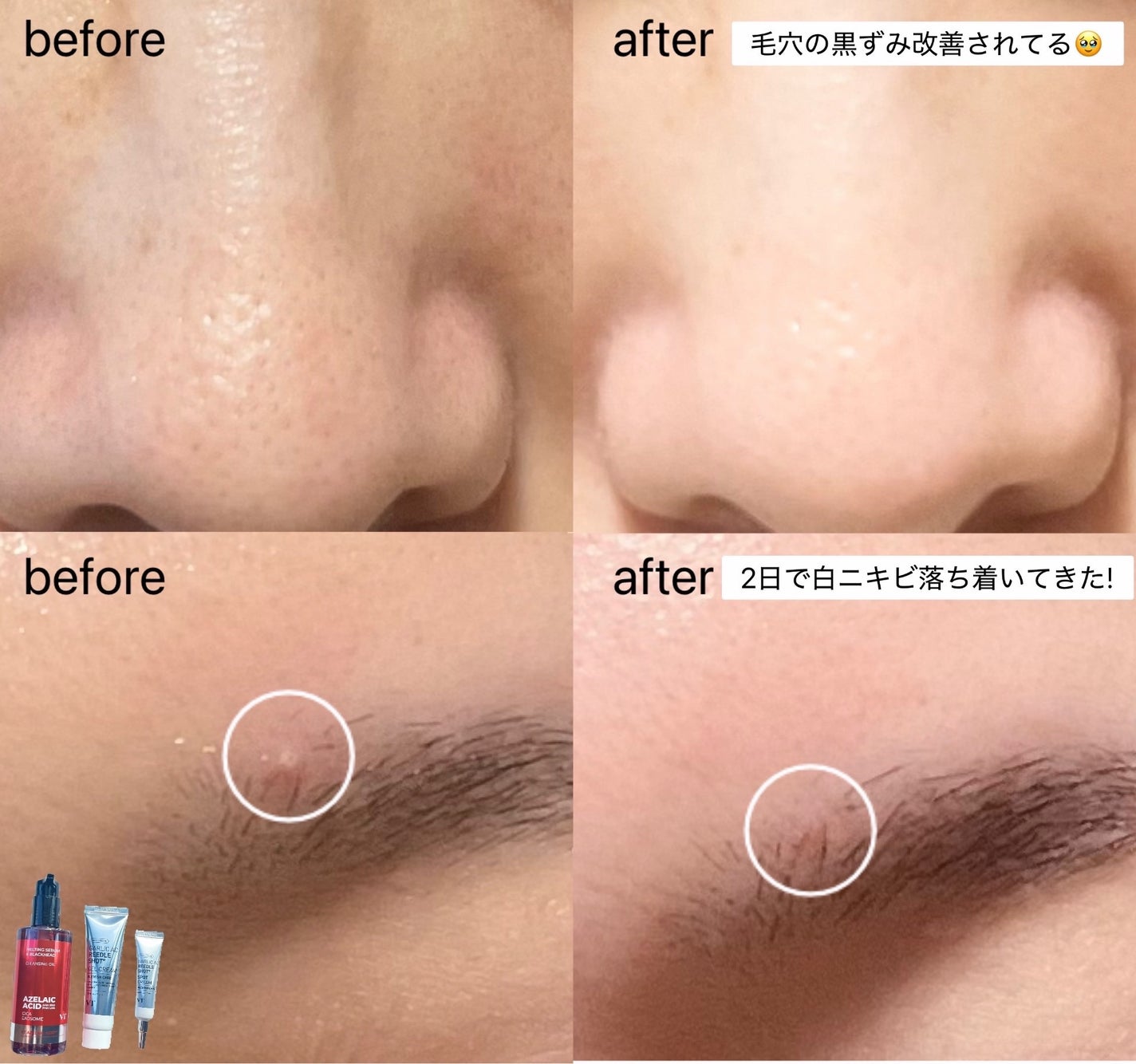 AZケア クレンジングオイル/VT/オイルクレンジングを使ったクチコミ(4枚目)