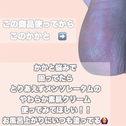 やわらか素肌クリームU (第3医薬品) 90g/メンソレータム/その他の画像