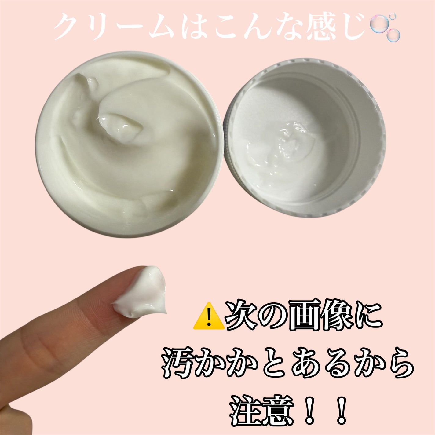 やわらか素肌クリームU (第3医薬品)/メンソレータム/その他を使ったクチコミ(2枚目)