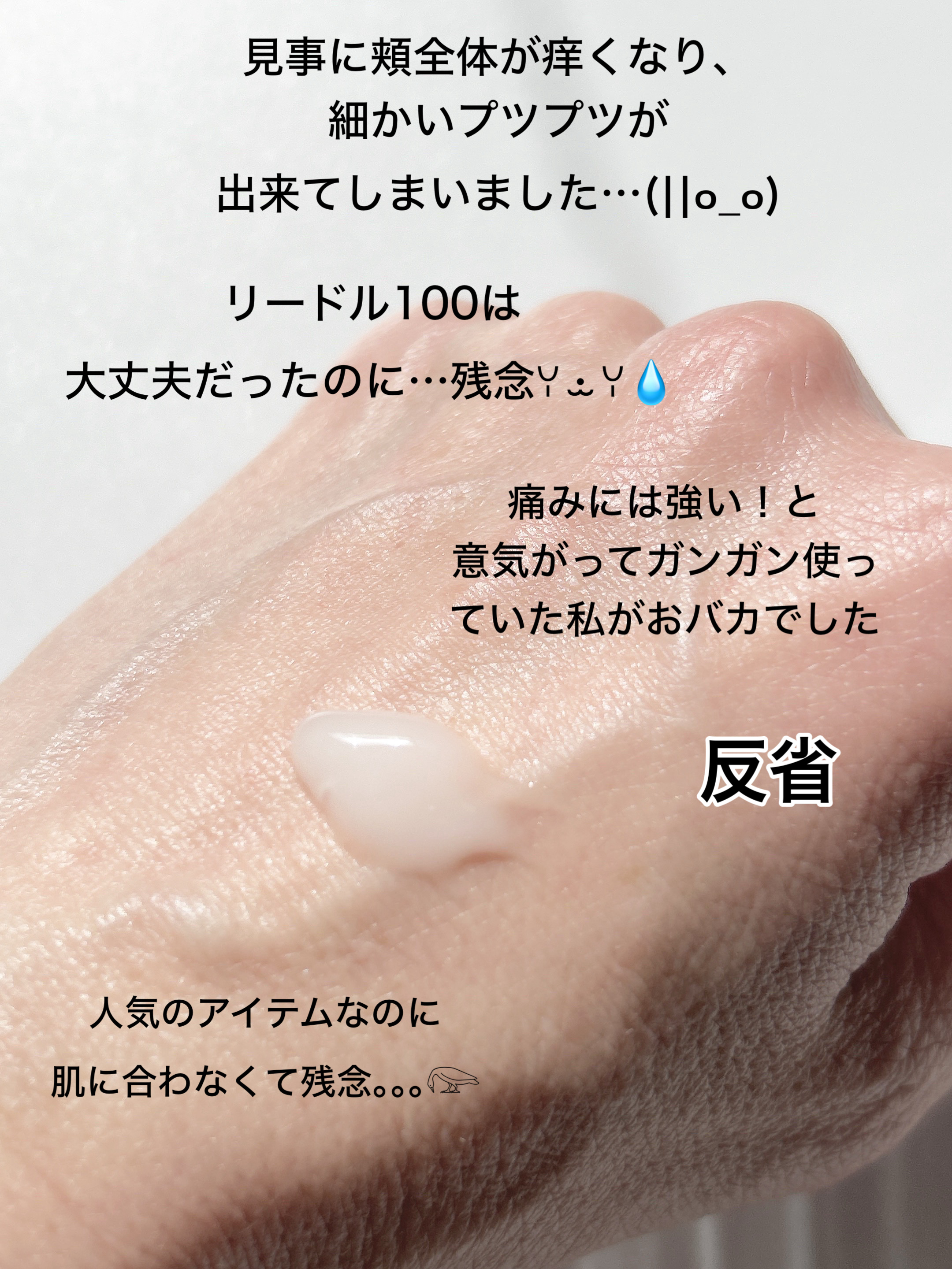 リードルショット300/VT/美容液を使ったクチコミ（3枚目）