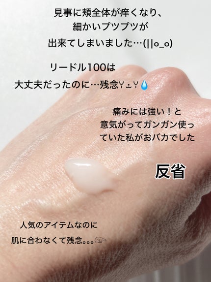 リードルショット300/VT/美容液を使ったクチコミ(3枚目)