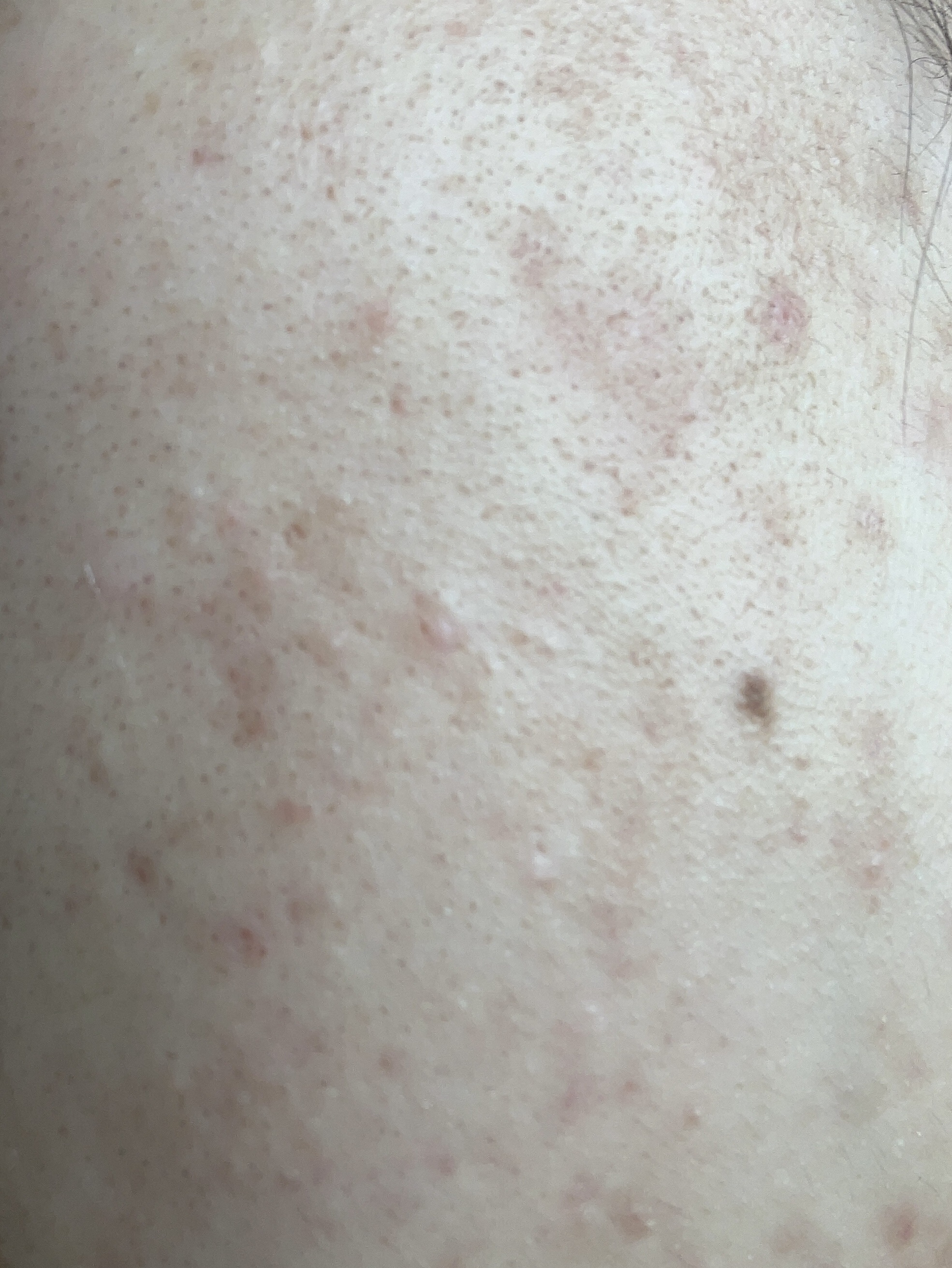 薬用ローション（とてもしっとり）/IHADA/化粧水を使ったクチコミ（1枚目）