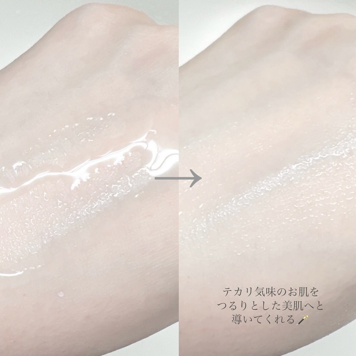 コノド　アゼラケアエッセンス/CONODO/美容液を使ったクチコミ（3枚目）