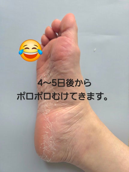 Annyo フットパック カウ柄 ヴァーベナの香り/ピエラス/レッグ・フットケアを使ったクチコミ(4枚目)