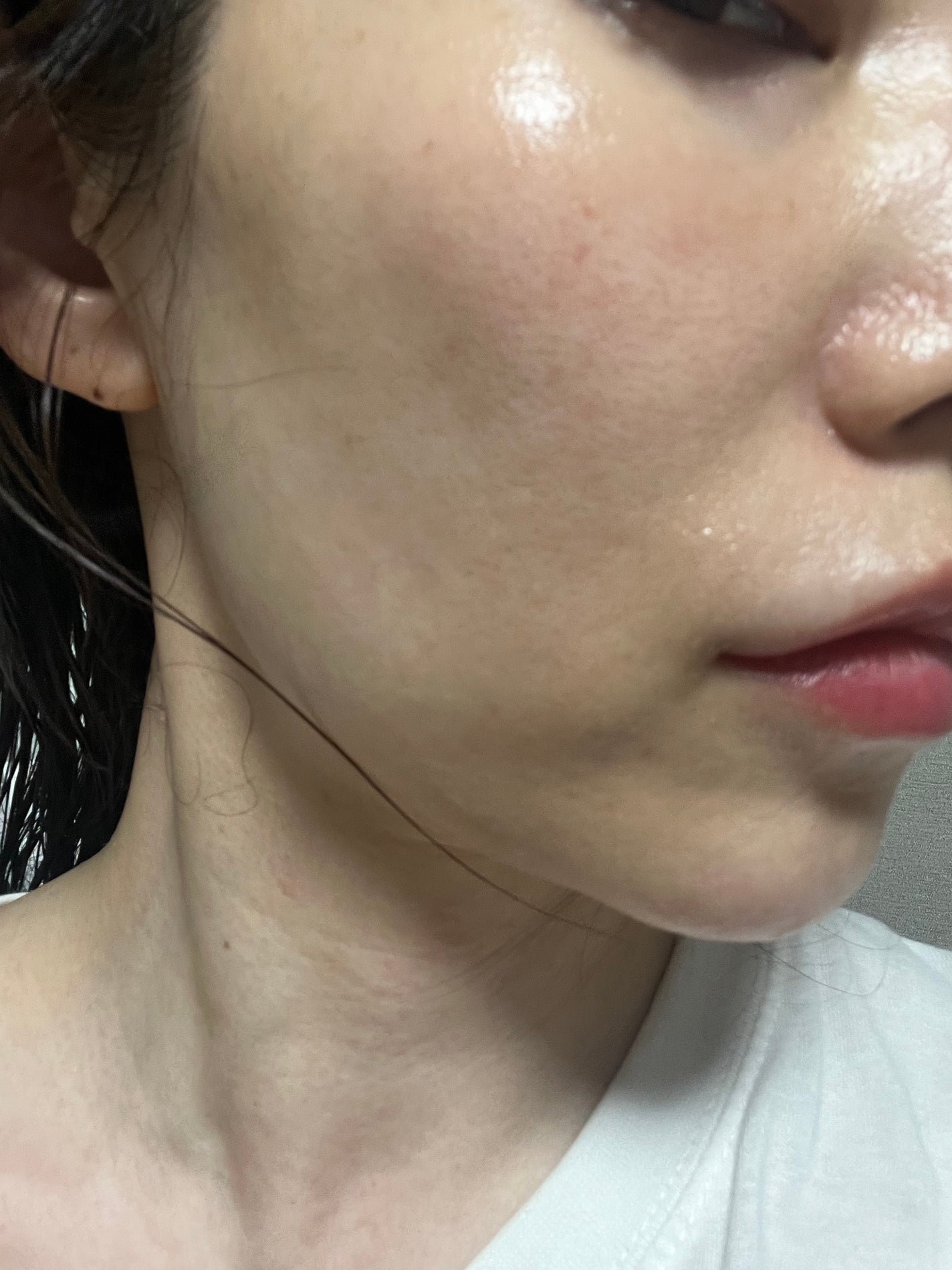 エキソプラン ホワイトニングインテンスアンプル/Cellinstem/美容液を使ったクチコミ(3枚目)