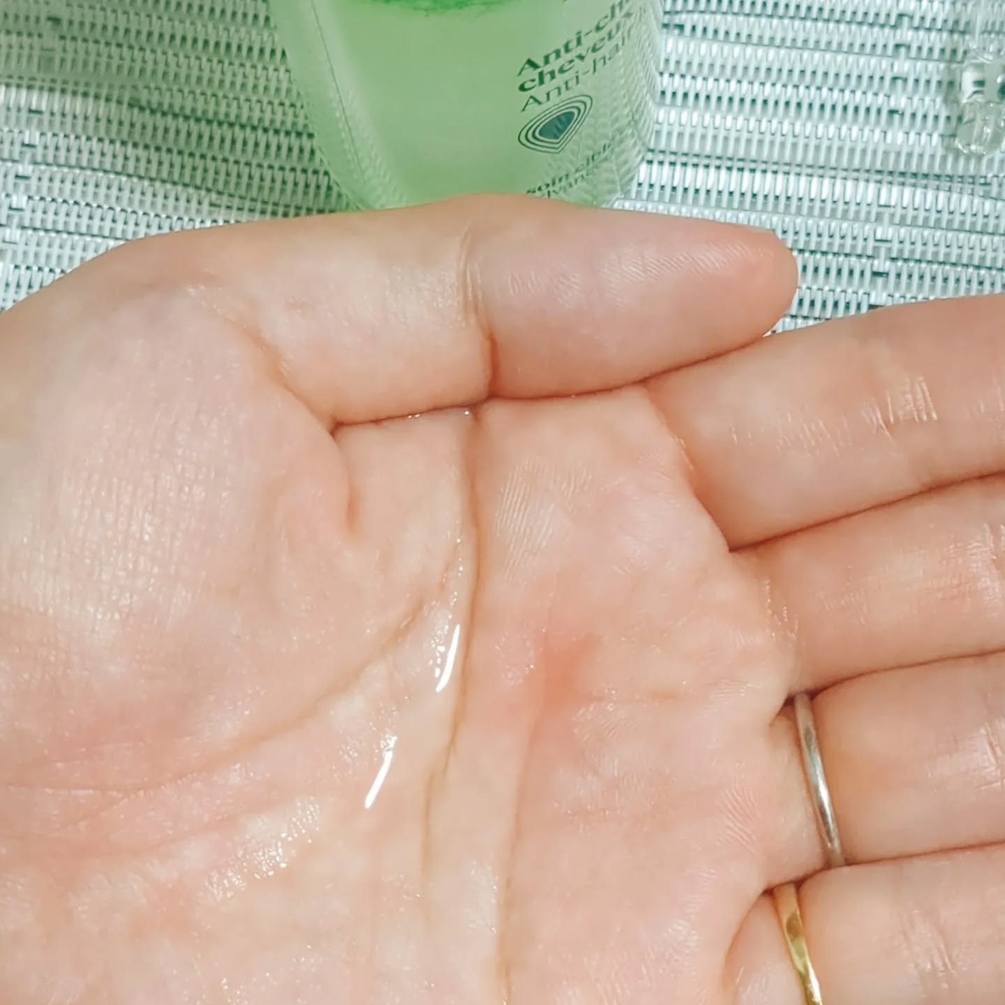 薬用 メディカル アンチヘアロスセラム/L'OCCITANE/頭皮ローションを使ったクチコミ（3枚目）