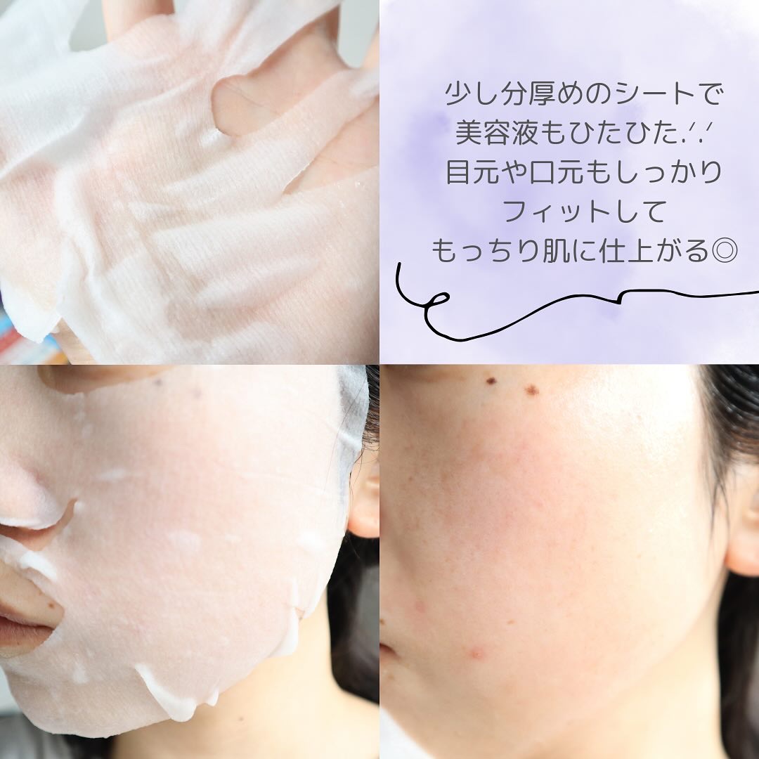ルルルン ハイドラ EX マスク/ルルルン/シートマスク・パックを使ったクチコミ（2枚目）