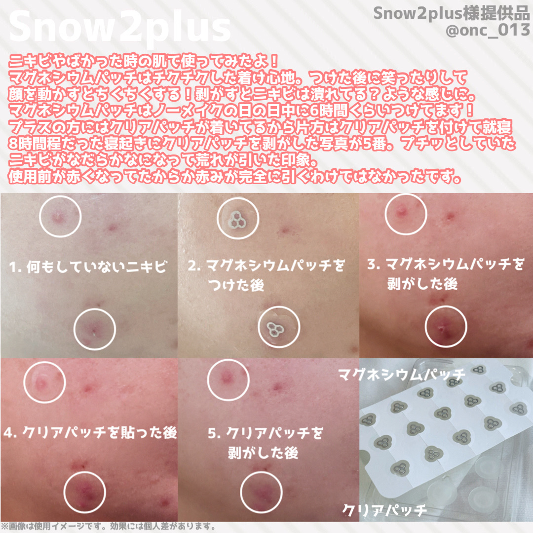 ACマグネシウムパッチ/スノーツープラス/シートマスク・パックを使ったクチコミ（2枚目）