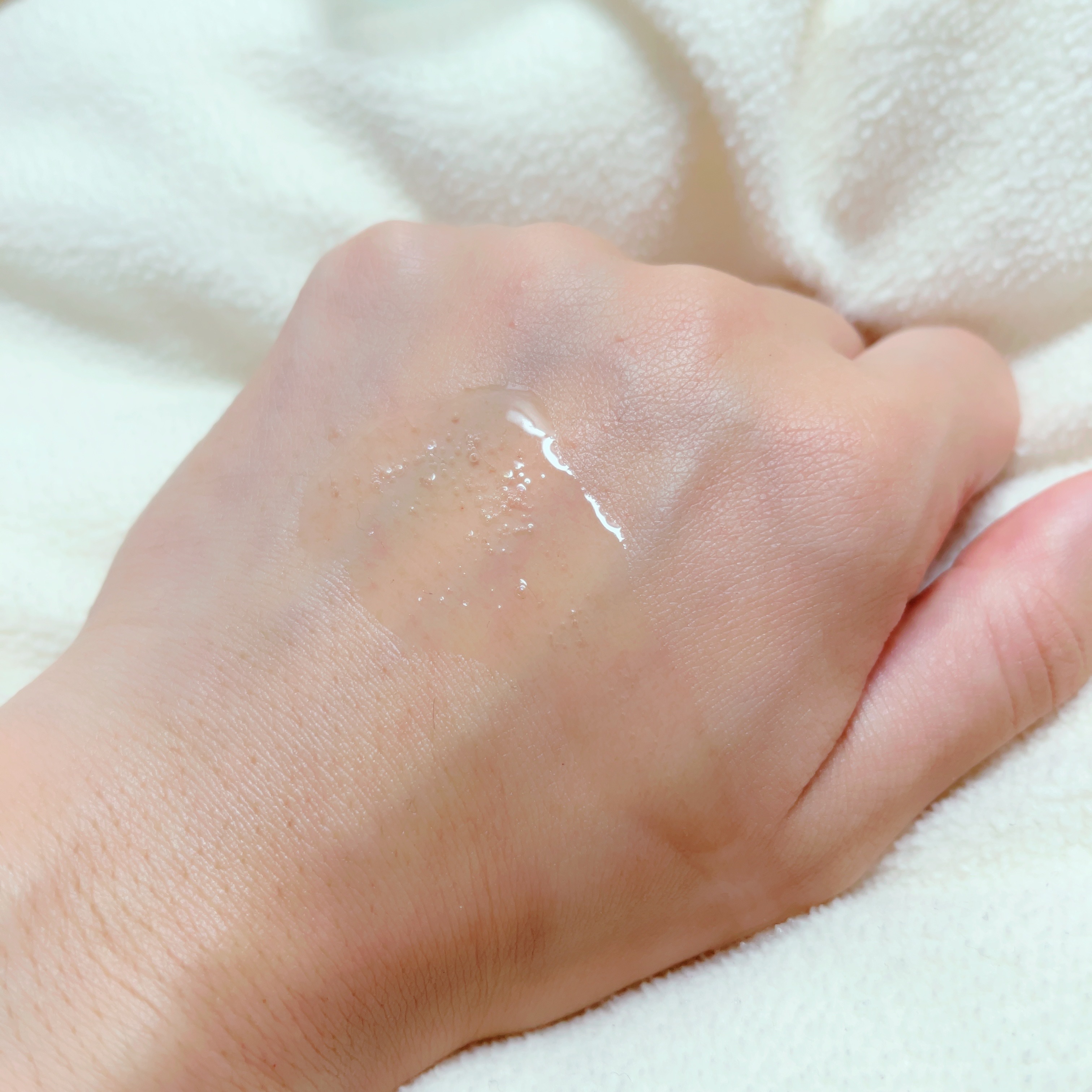 カルテHD バランスケア ローション 150ml/カルテHD/化粧水を使ったクチコミ（2枚目）