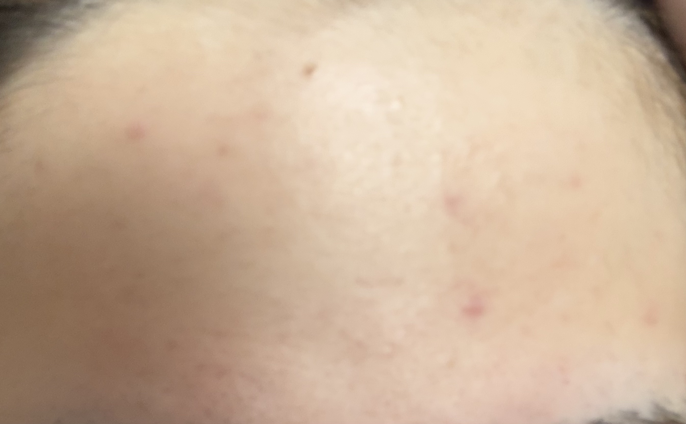 潤浸保湿 化粧水 III とてもしっとり/キュレル/化粧水を使ったクチコミ（3枚目）