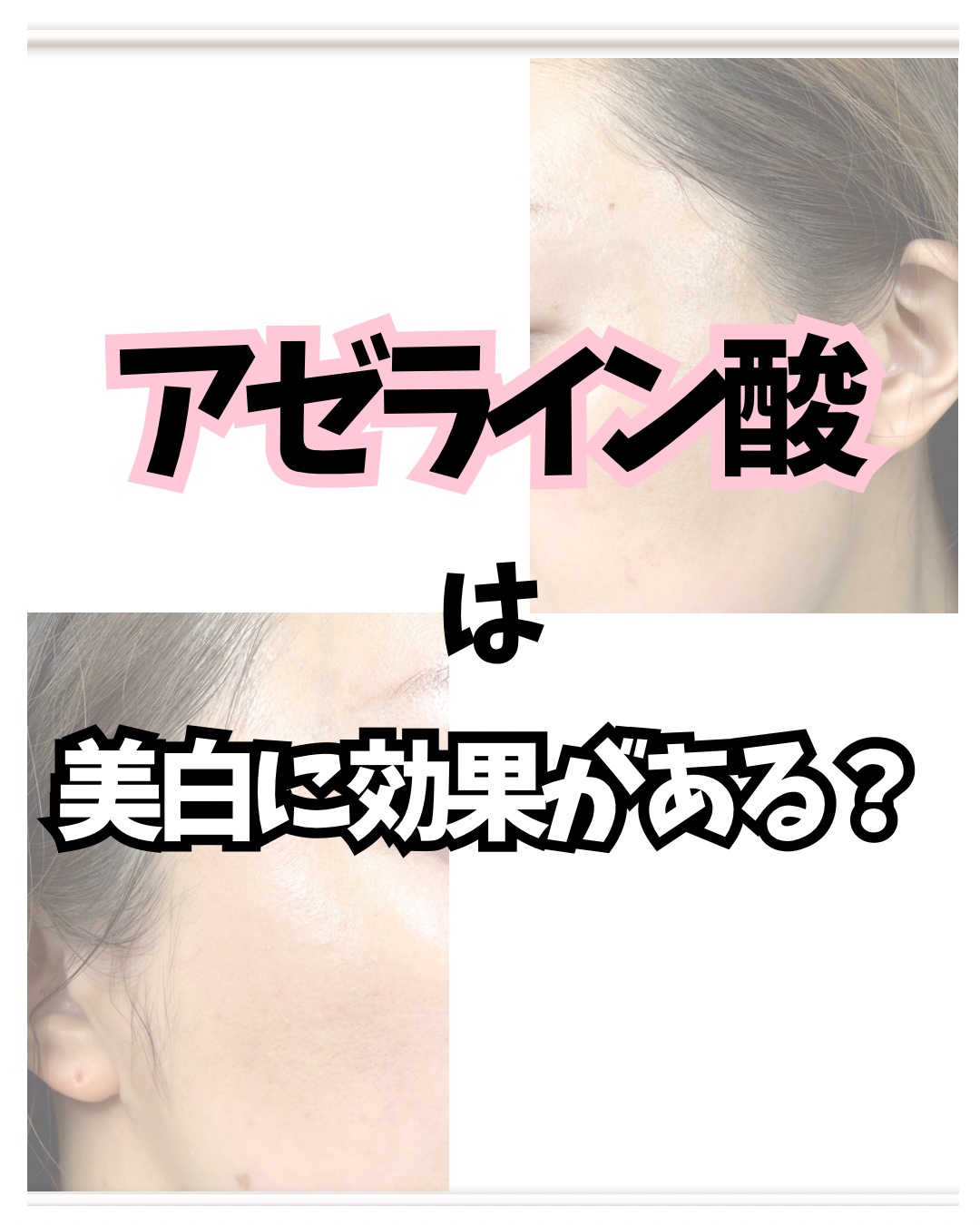 A.Cクリーム　プレミアム/LEPOREM/フェイスクリームを使ったクチコミ（1枚目）