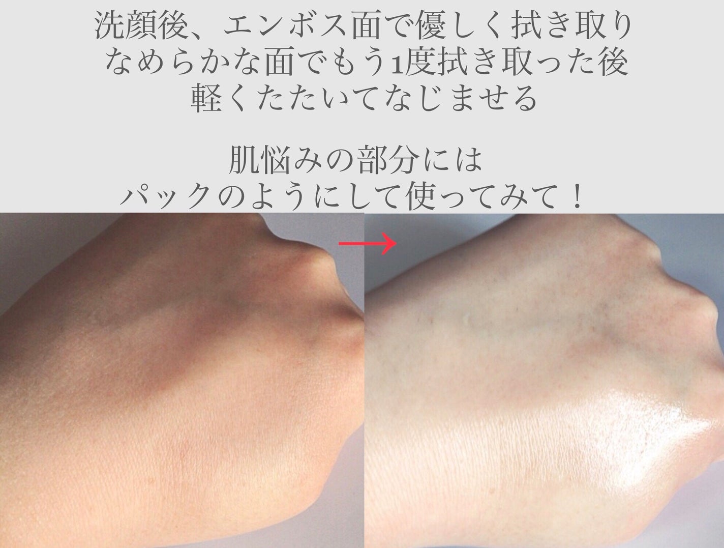 デイリートナーパッド/NEEDLY/トナーパッドを使ったクチコミ(3枚目)