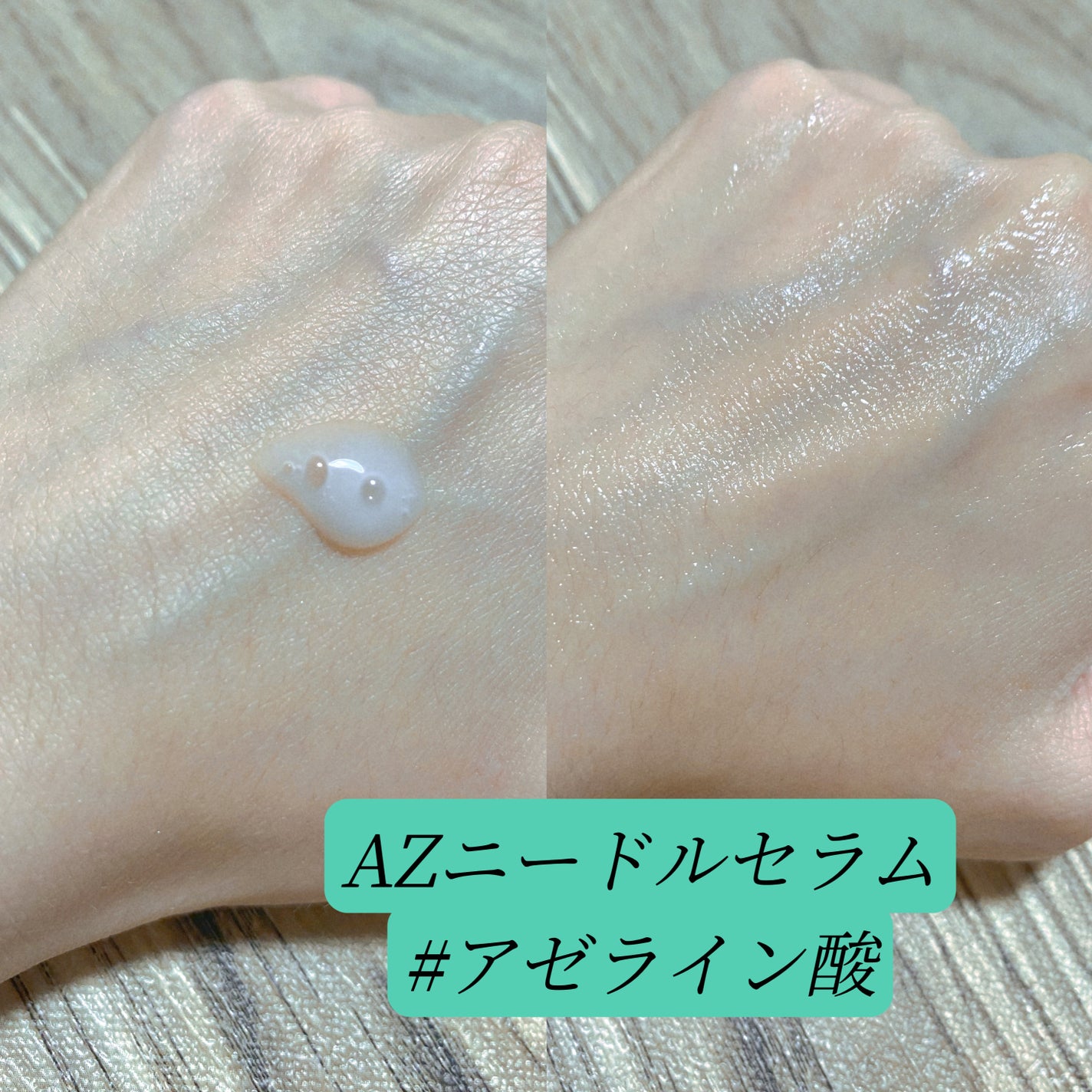 ニードルセラム アゼライン酸/LEPOREM/美容液を使ったクチコミ(2枚目)