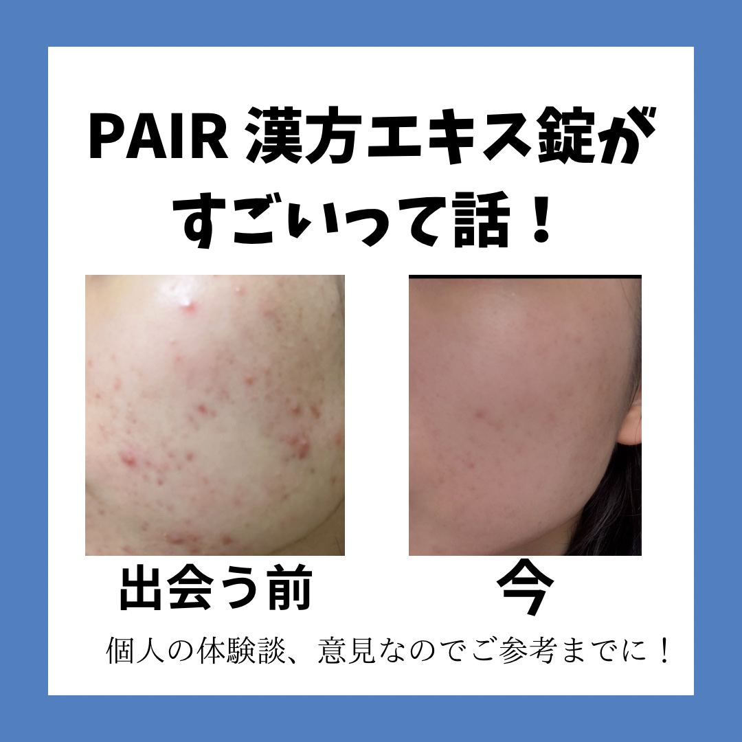 ペア漢方エキス錠（医薬品）/ペア/その他を使ったクチコミ（1枚目）