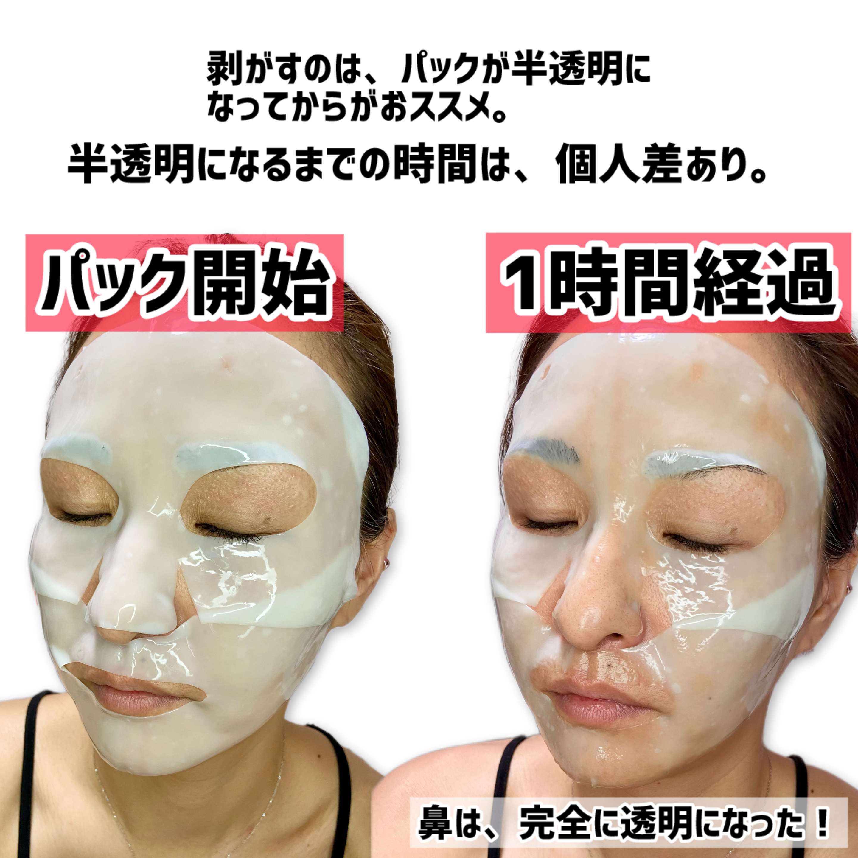 プレミアムシカトリートメントフィッティングマスクパック/WellDerma/シートマスク・パックを使ったクチコミ（3枚目）