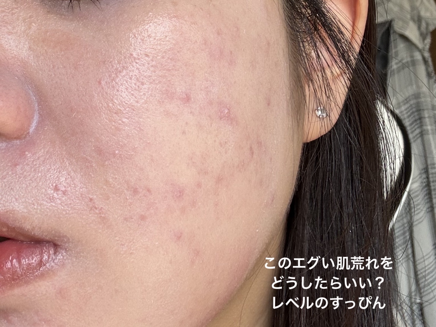 オールデイモイストリキッドファンデーション/vim BEAUTY/リキッドファンデーションを使ったクチコミ（2枚目）