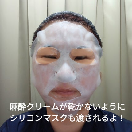 ダーマペン4/SBC/その他を使ったクチコミ(2枚目)