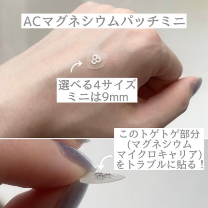 ACマグネシウムパッチ/スノーツープラス/シートマスク・パックを使ったクチコミ(3枚目)