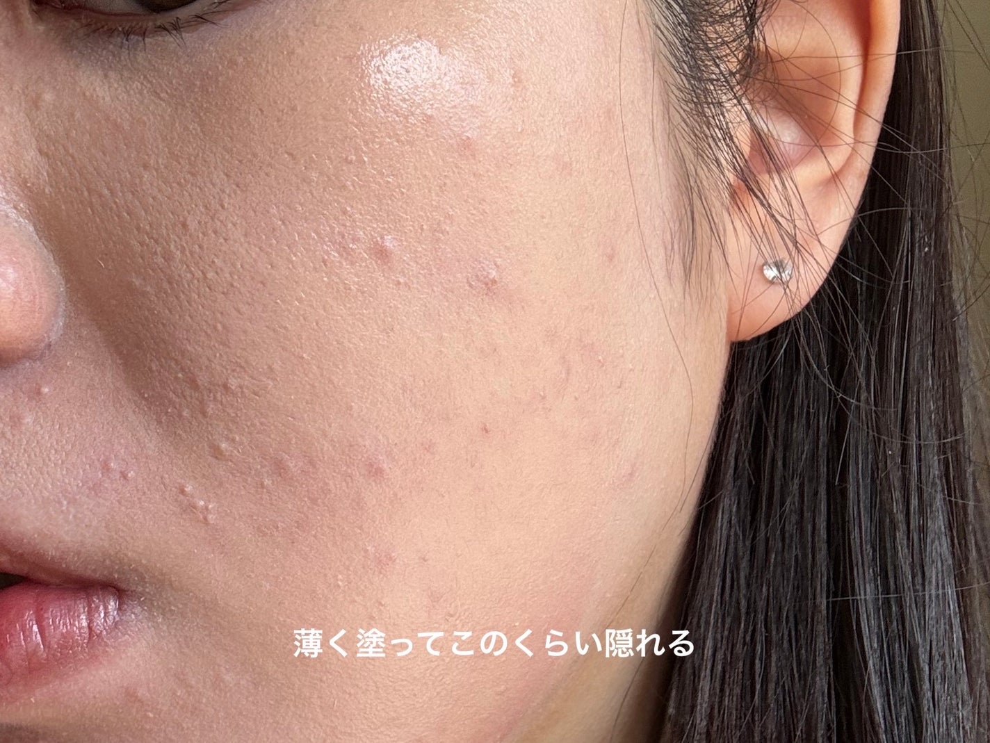 オールデイモイストリキッドファンデーション/vim BEAUTY/リキッドファンデーションを使ったクチコミ(3枚目)