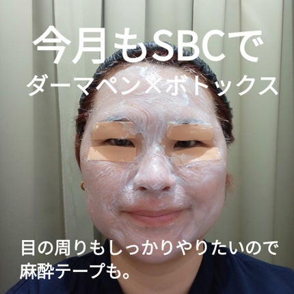 ダーマペン4/SBC/その他を使ったクチコミ(1枚目)