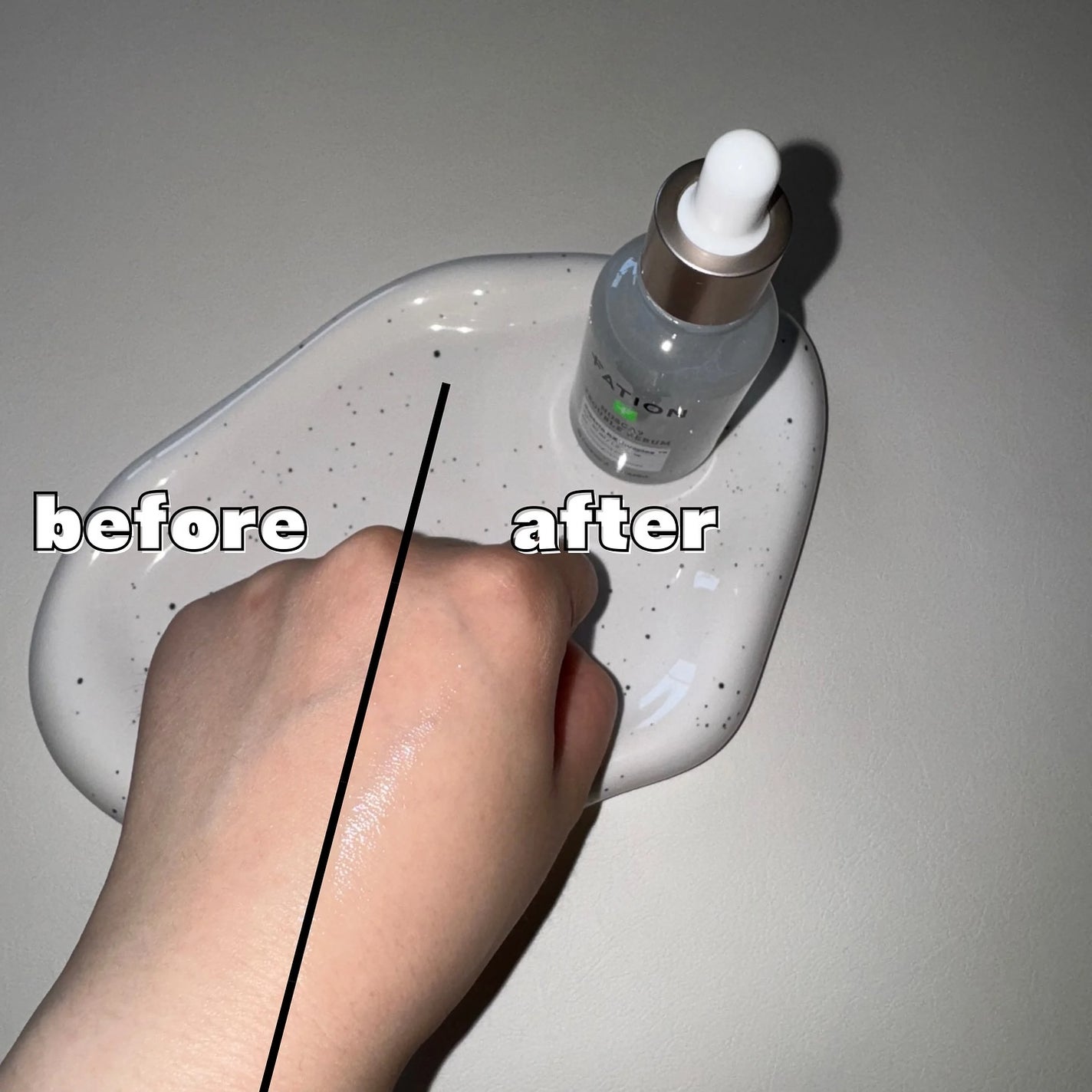 ユリナ on LIPS 「^^FATIONsamaの肌荒れやニキビに悩む方におおすめの鎮..」(5枚目)