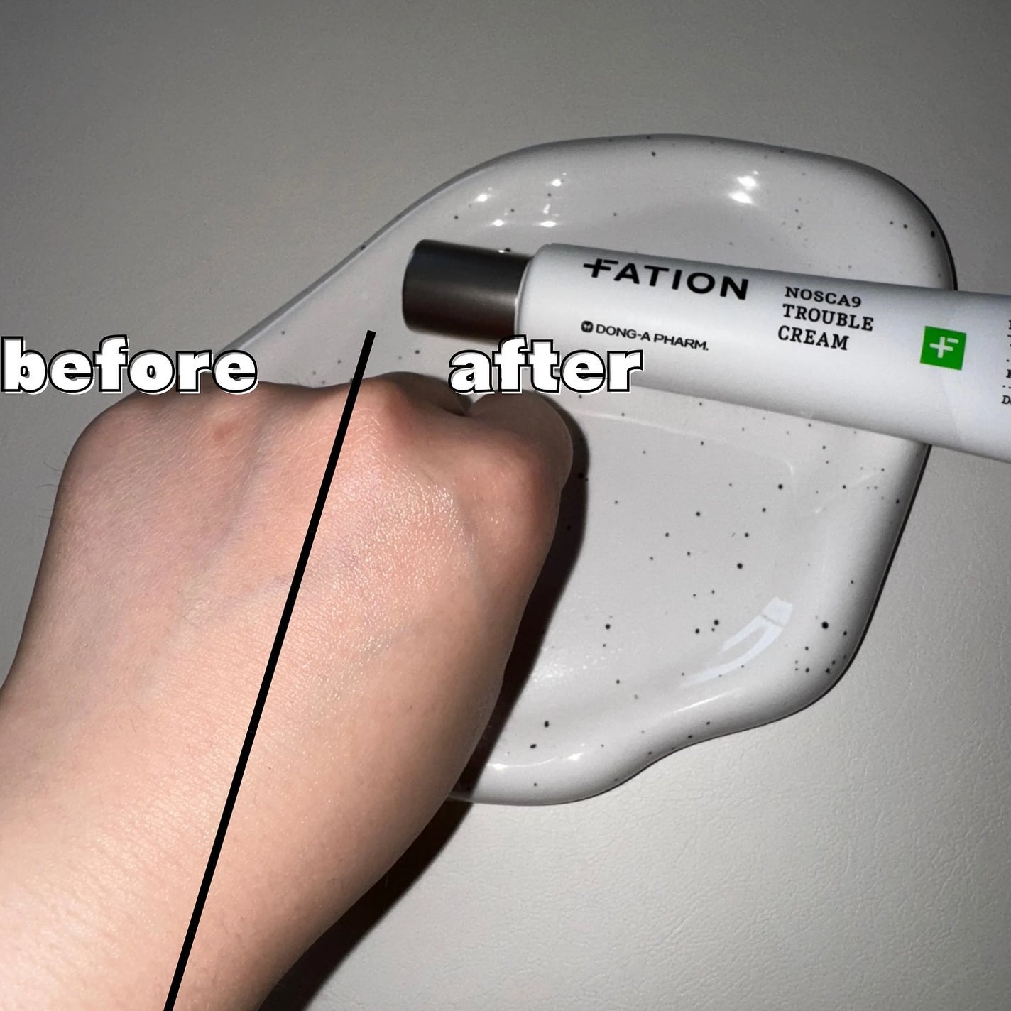 ユリナ on LIPS 「^^FATIONsamaの肌荒れやニキビに悩む方におおすめの鎮..」(9枚目)