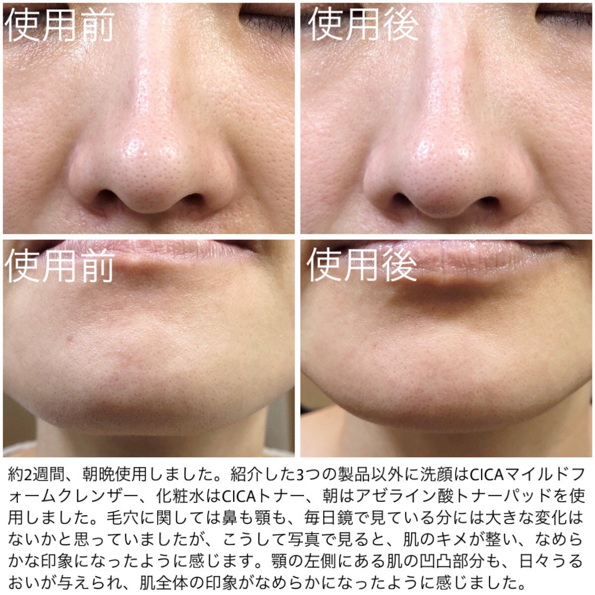 AZケア クレンジングオイル/VT/オイルクレンジングを使ったクチコミ(5枚目)