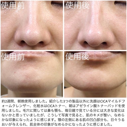 AZケア クレンジングオイル/VT/オイルクレンジングを使ったクチコミ(5枚目)