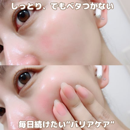 アトバリア365クリーム/AESTURA/フェイスクリームを使ったクチコミ(4枚目)