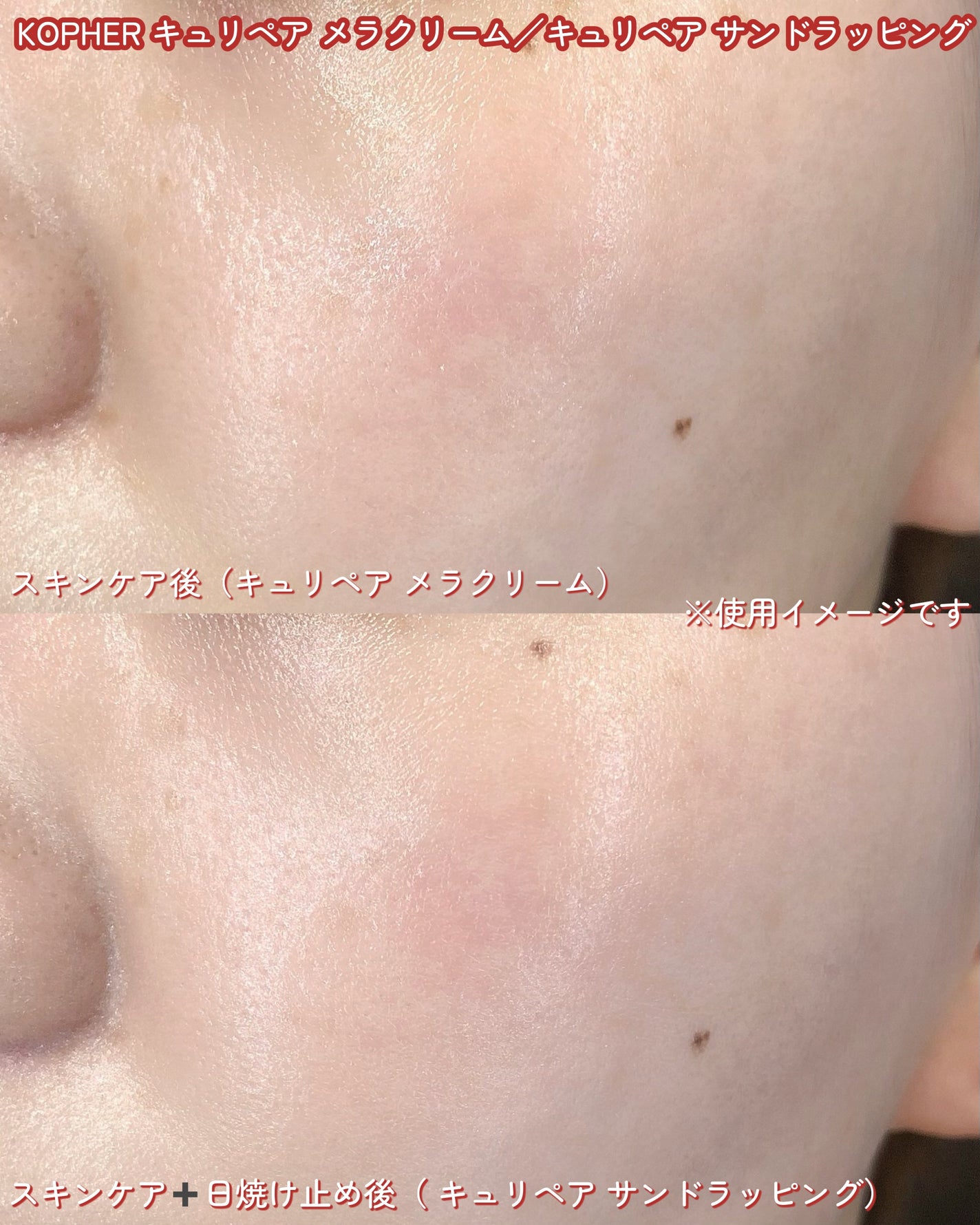 CUREPAIR MELA CREAM /KOPHER/フェイスクリームを使ったクチコミ(4枚目)