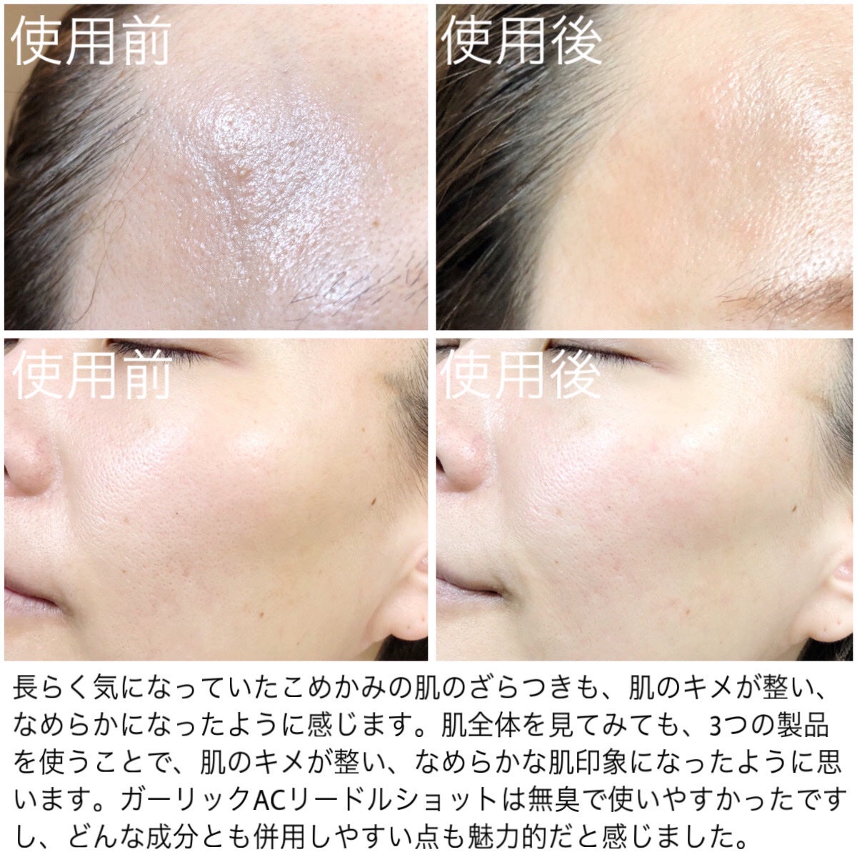 AZケア クレンジングオイル/VT/オイルクレンジングを使ったクチコミ(6枚目)