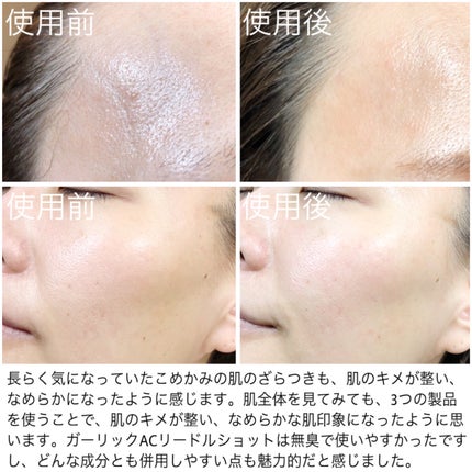 AZケア クレンジングオイル/VT/オイルクレンジングを使ったクチコミ(6枚目)