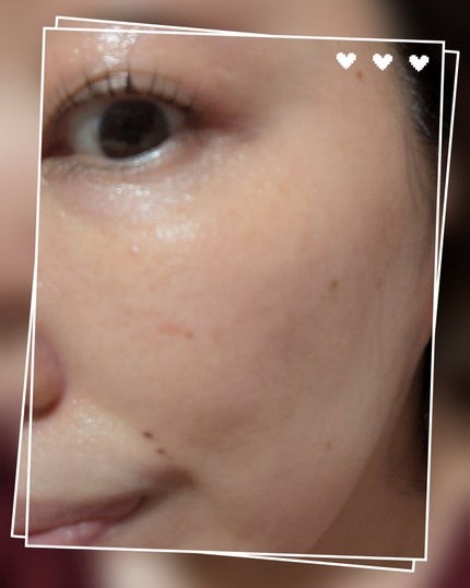 ルルルン ハイドラ V マスク/ルルルン/シートマスク・パックを使ったクチコミ(5枚目)