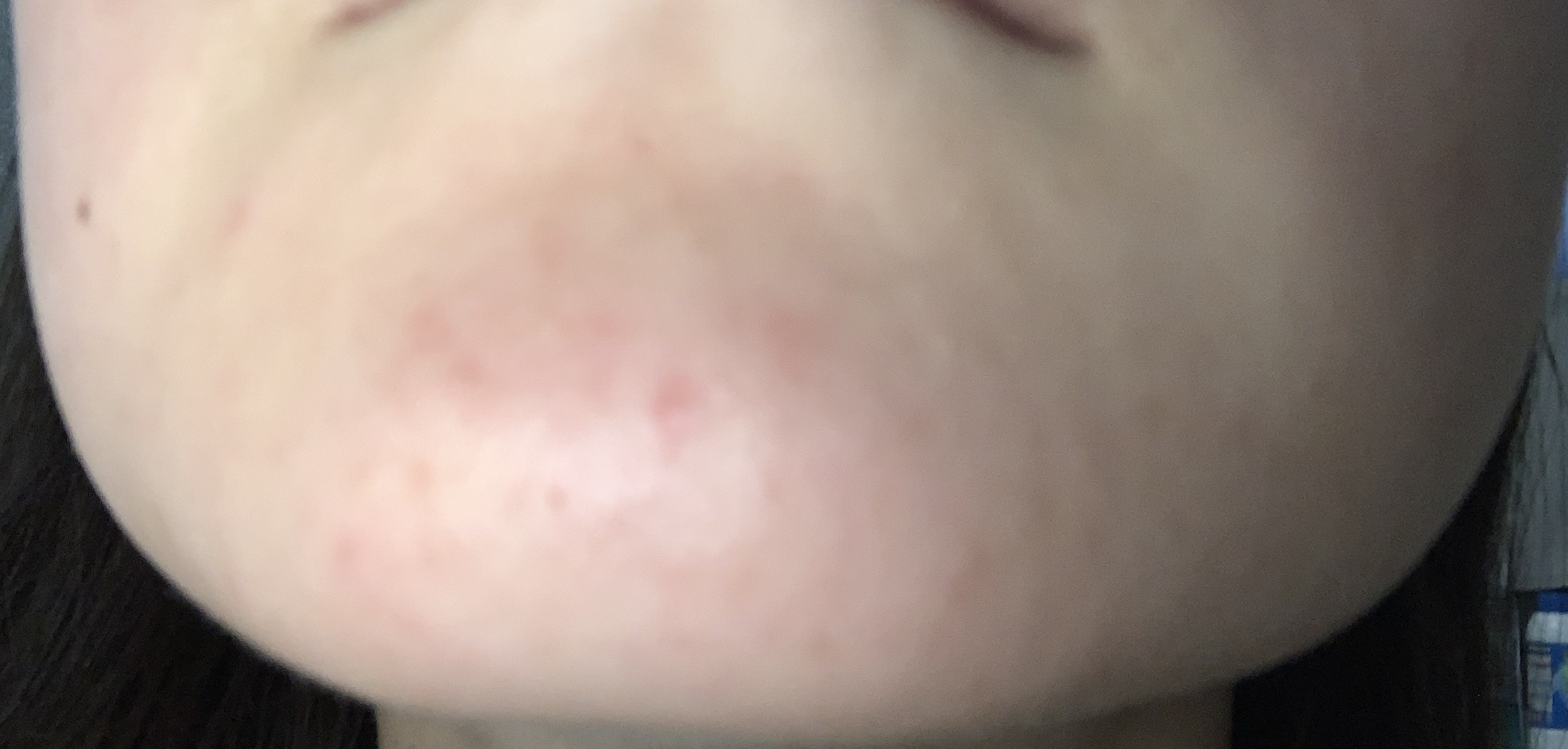 パーフェクトホイップ コラーゲンin/SENKA（専科）/洗顔フォームを使ったクチコミ（2枚目）