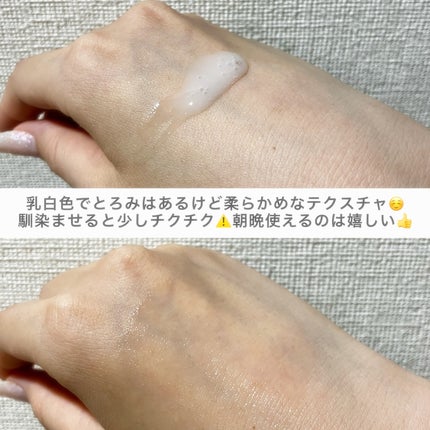 ð¥-ãªãããŸã-ð¥ on LIPS ãæ¯ç©Žã»ããã€ãã«ãæ©ã¿ã®æ¹å¿
èŠð«§ã«ãã¬ã ã®AZããŒãã«ã»ã©ã ã¯..ãïŒ4æç®ïŒ