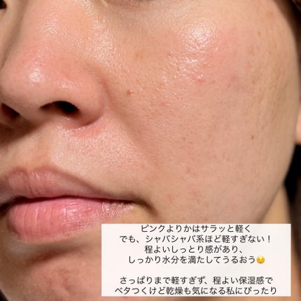 モイスチュア ローション/カルテHD/化粧水を使ったクチコミ(7枚目)