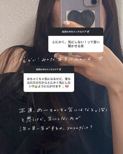 yuyuð¶èèãäœè³ªã®æ£çŽã¬ãã¥ãŒ on LIPS ãèèãäžã®ã¡ã³ã¿ã«ãã©ããã£ãŠä¿ã£ãŠãïŒåã«ã¹ããŒãªãŒã§ãã©ã..ãïŒ4æç®ïŒ