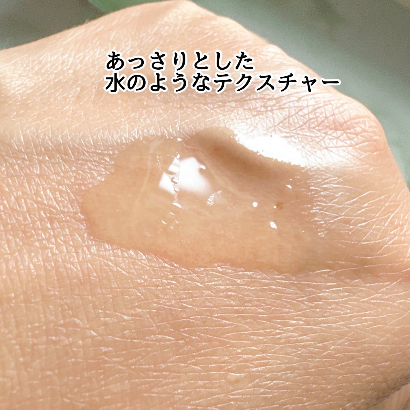 薬用 メディカル アンチヘアロスセラム/L'OCCITANE/頭皮ローションを使ったクチコミ(3枚目)