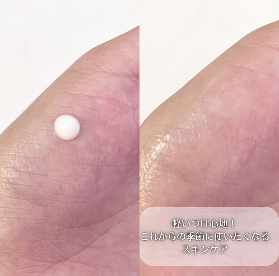 Hug Your Skin Moisture Lotion/celepiderme/化粧水を使ったクチコミ（3枚目）