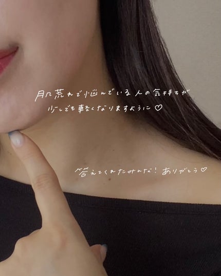 yuyuð¶èèãäœè³ªã®æ£çŽã¬ãã¥ãŒ on LIPS ãèèãäžã®ã¡ã³ã¿ã«ãã©ããã£ãŠä¿ã£ãŠãïŒåã«ã¹ããŒãªãŒã§ãã©ã..ãïŒ9æç®ïŒ