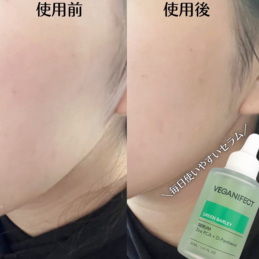 青麦ジンクセラム/Veganifect/美容液を使ったクチコミ(3枚目)