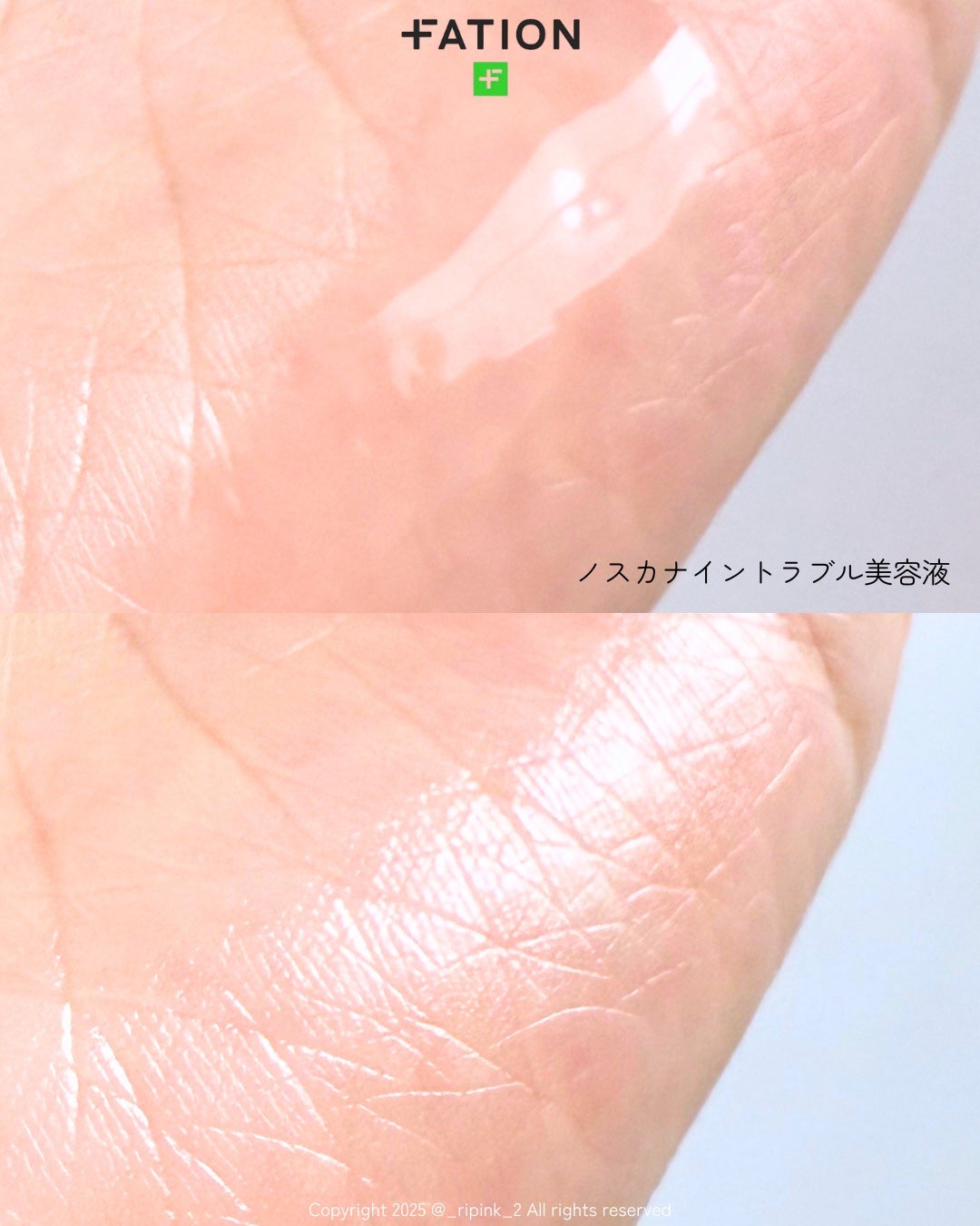 ノスカナイン トラブル セラム/FATION/美容液を使ったクチコミ(4枚目)