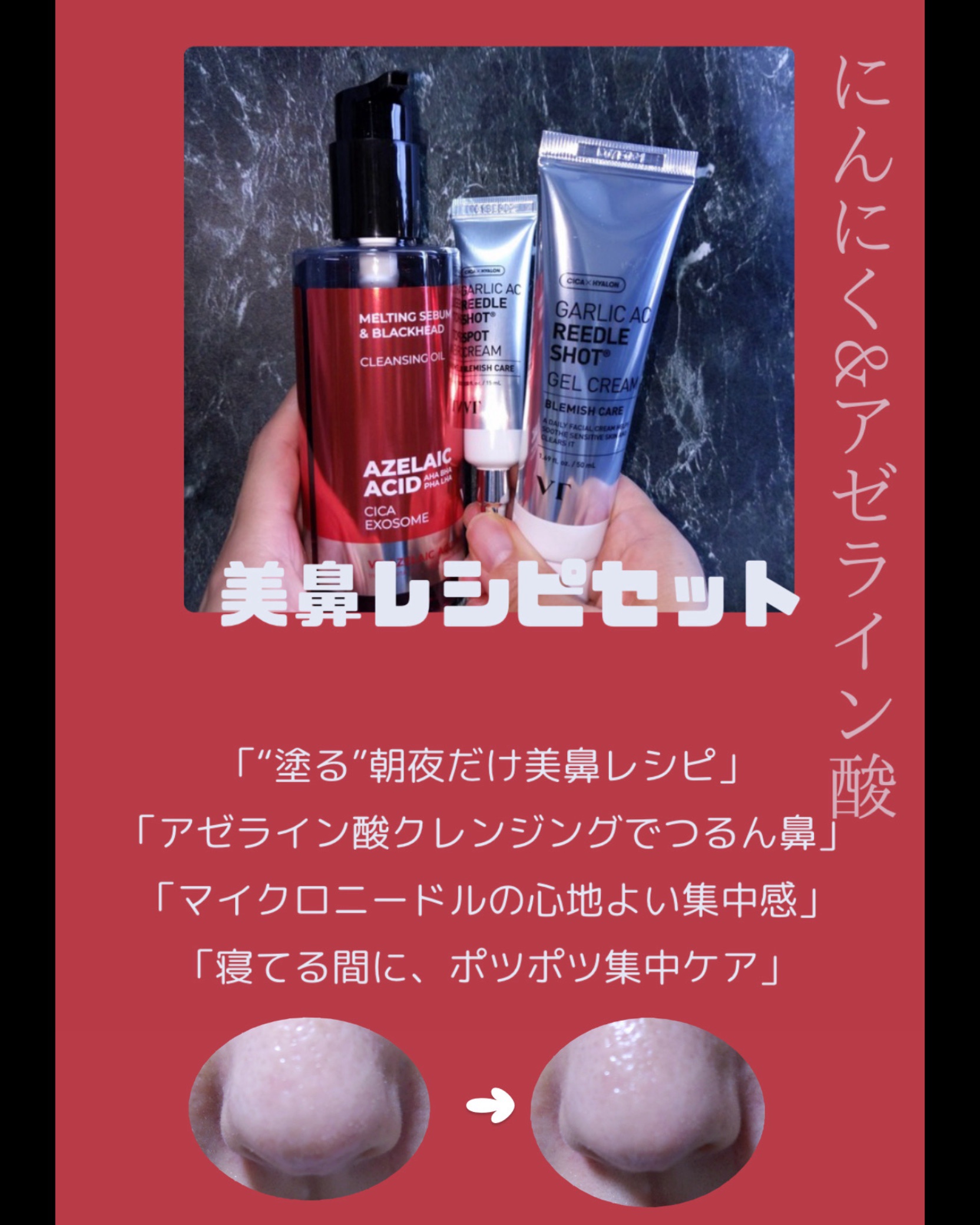 ガーリックリードルショット ジェルクリーム/VT/フェイスクリームを使ったクチコミ（2枚目）