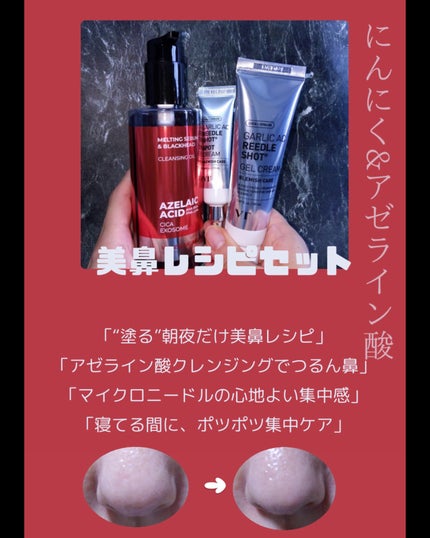 ガーリックリードルショット ジェルクリーム/VT/フェイスクリームを使ったクチコミ(2枚目)